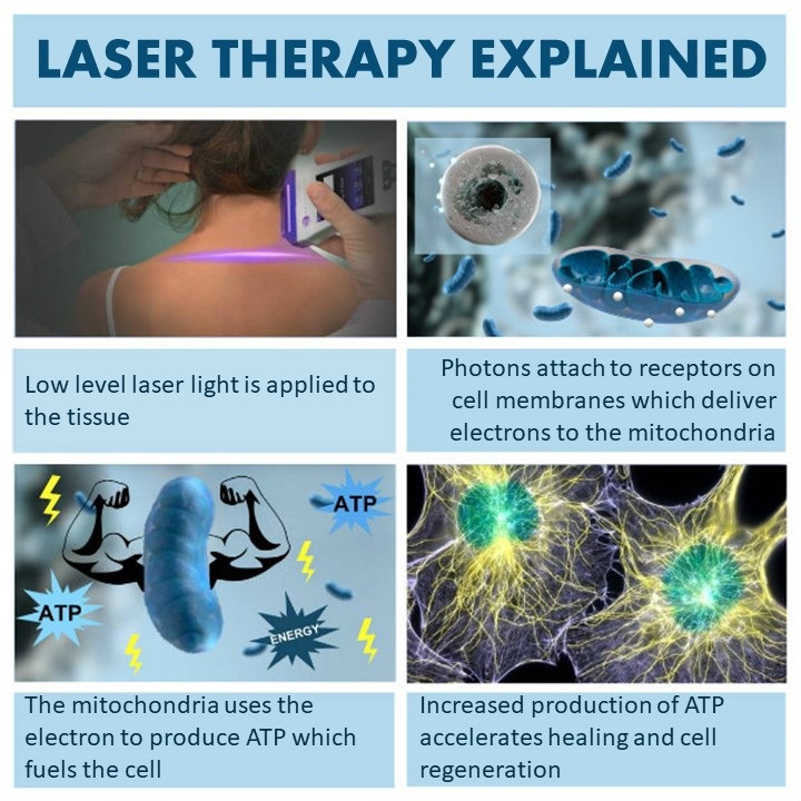 Cold Laser Therapy Explained with Authentic Health